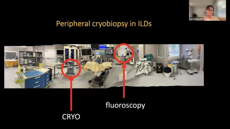 Criobiopsia polmonare transbronchiale - Lezione del 13/01/2026